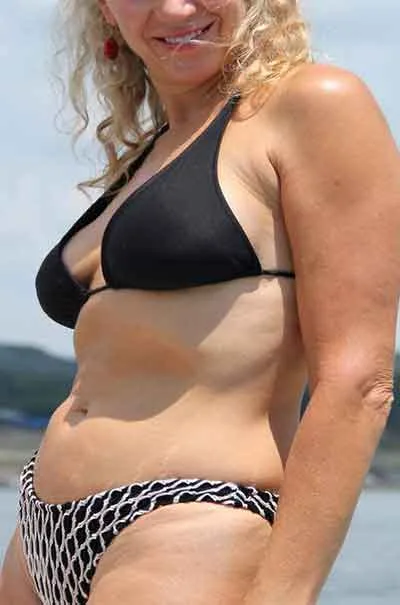 Anette Blakstad